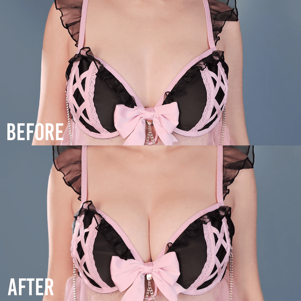 Jiggle Defender Silicone Adhesive Bra - MOEFLAVOR - Waifu Inspired Fashion and Lingerie Store
