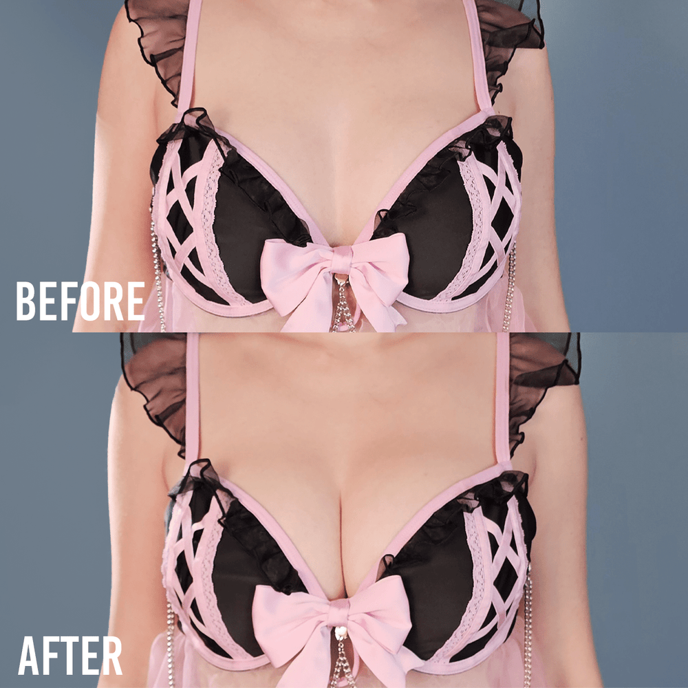 Jiggle Defender Silicone Adhesive Bra - MOEFLAVOR - Waifu Inspired Fashion and Lingerie Store